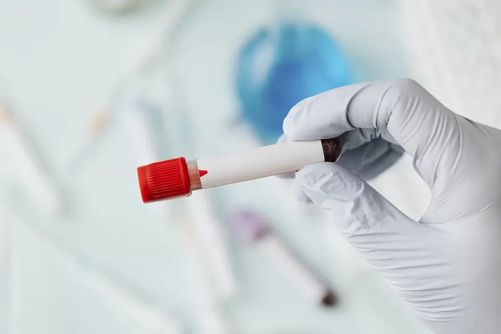 The BSI 43 Day Detox, with 133 Lab Tests and Comprehensive Analysis